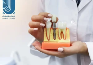 سعر زراعة السن في السعوديه